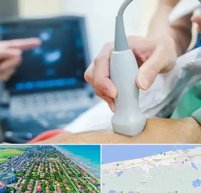 اکو قلب شبانه روزی در فریدونکنار