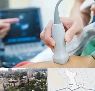 اکو قلب شبانه روزی در اوین