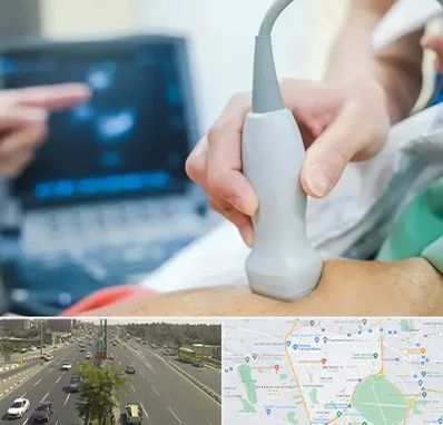 اکو قلب شبانه روزی در منطقه 17 تهران 