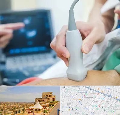 اکو قلب شبانه روزی در هاشمیه مشهد