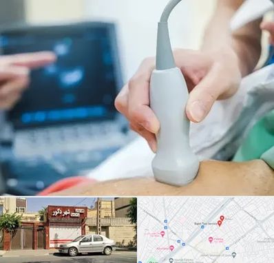 اکو قلب شبانه روزی در باجک قم