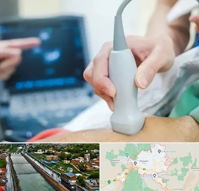 اکو قلب شبانه روزی در مراغه