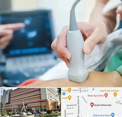 اکو قلب شبانه روزی در سهروردی 