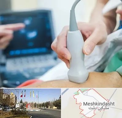اکو قلب شبانه روزی در مشکین دشت