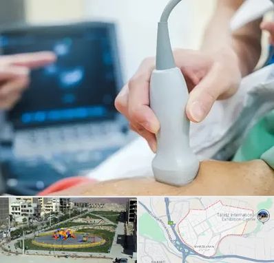 اکو قلب شبانه روزی در مرزداران تبریز