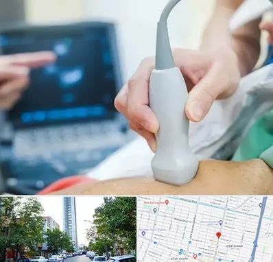 اکو قلب شبانه روزی در امامت مشهد