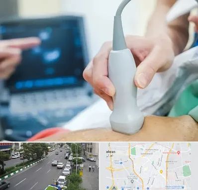 اکو قلب شبانه روزی در ستارخان 