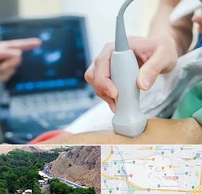 اکو قلب شبانه روزی در کن 