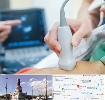 اکو قلب شبانه روزی در کارگر جنوبی 