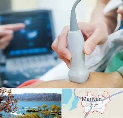 اکو قلب شبانه روزی در مریوان
