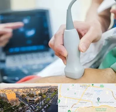 اکو قلب شبانه روزی در تهرانپارس 