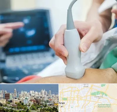 اکو قلب شبانه روزی در شرق تهران 