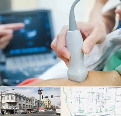 اکو قلب شبانه روزی در 17شهریور