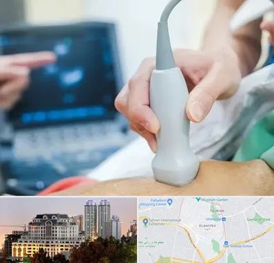 اکو قلب شبانه روزی در فرشته 