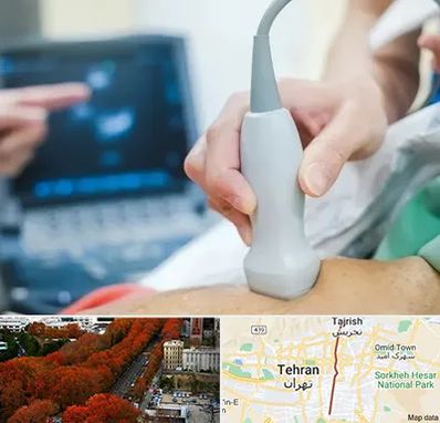 اکو قلب شبانه روزی در ولیعصر 