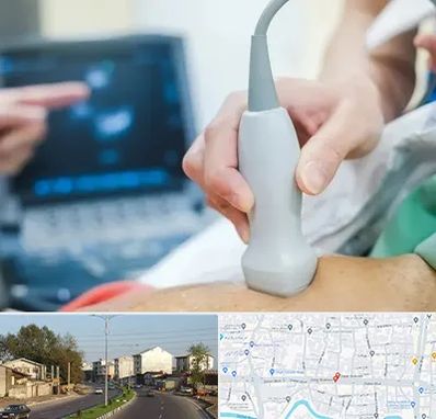 اکو قلب شبانه روزی در ضیابری رشت 