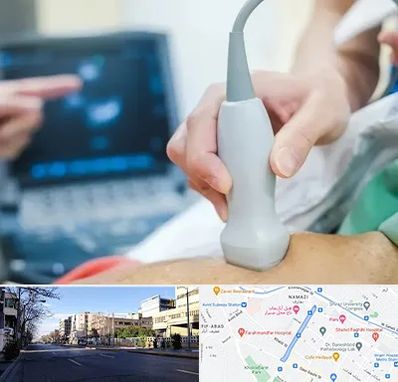 اکو قلب شبانه روزی در خیابان ملاصدرا شیراز