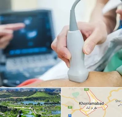 اکو قلب شبانه روزی در خرم آباد