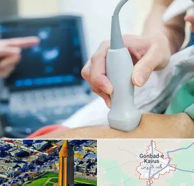 اکو قلب شبانه روزی در گنبد کاووس