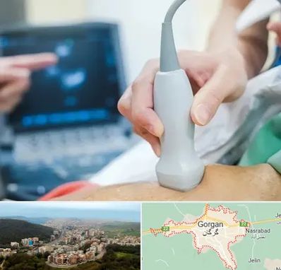 اکو قلب شبانه روزی در گرگان