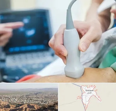 اکو قلب شبانه روزی در اسفراین