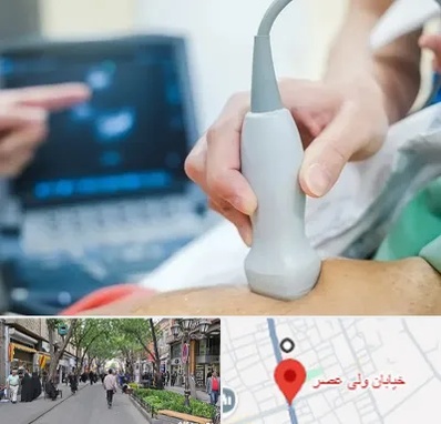 اکو قلب شبانه روزی در ولیعصر شهریار