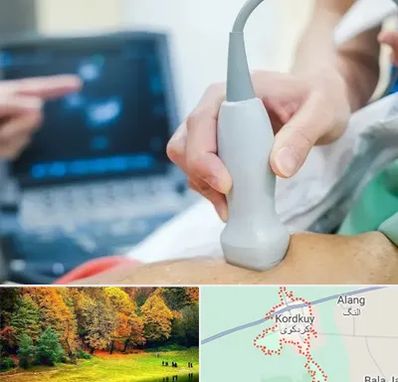 اکو قلب شبانه روزی در کردکوی