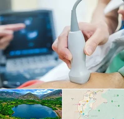 اکو قلب شبانه روزی در رودبار