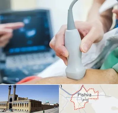 اکو قلب شبانه روزی در پیشوا