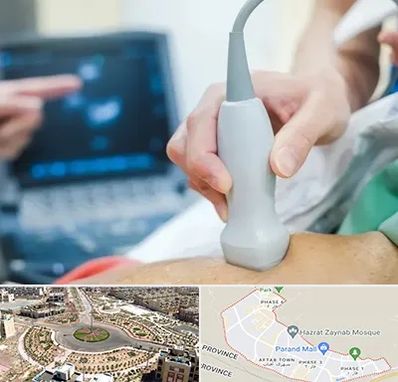 اکو قلب شبانه روزی در پرند