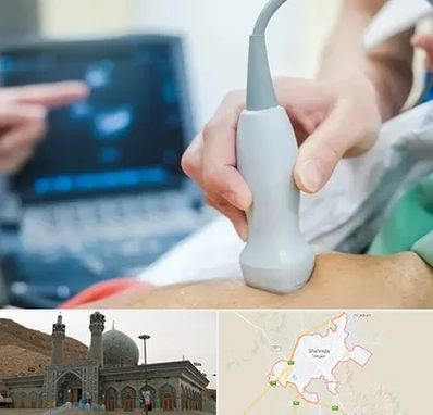 اکو قلب شبانه روزی در شهرضا