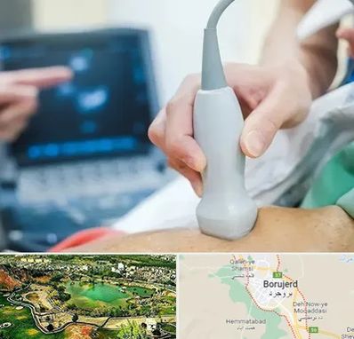 اکو قلب شبانه روزی در بروجرد