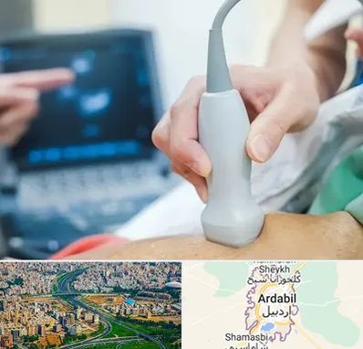 اکو قلب شبانه روزی در اردبیل