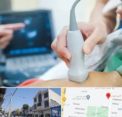 اکو قلب شبانه روزی در افسریه 