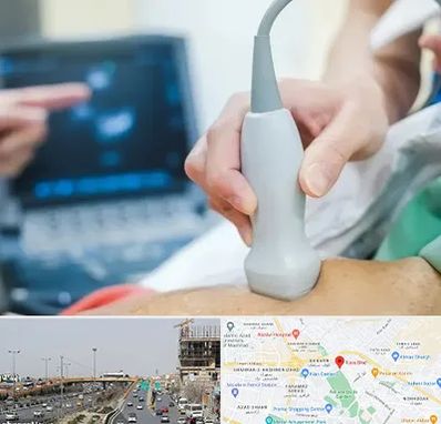 اکو قلب شبانه روزی در بلوار توس مشهد 