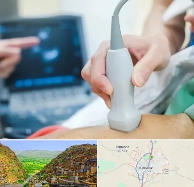 اکو قلب شبانه روزی در کامیاران