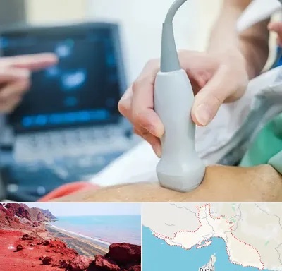 اکو قلب شبانه روزی در هرمزگان