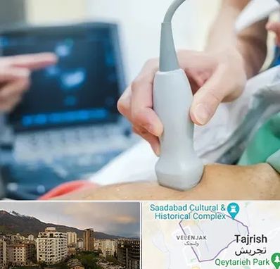 اکو قلب شبانه روزی در زعفرانیه 