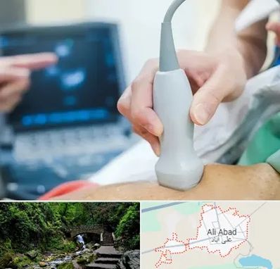 اکو قلب شبانه روزی در علی آباد کتول