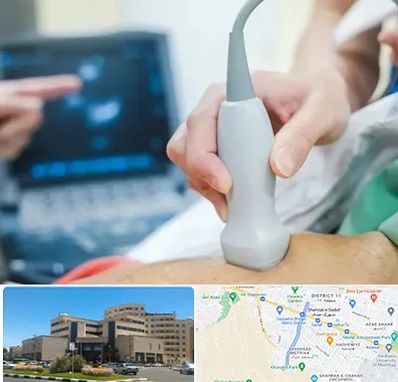 اکو قلب شبانه روزی در صیاد شیرازی مشهد