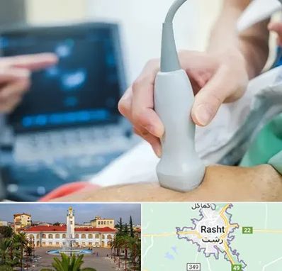 اکو قلب شبانه روزی در رشت