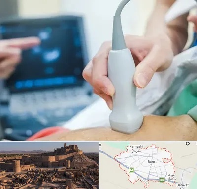 اکو قلب شبانه روزی در بم