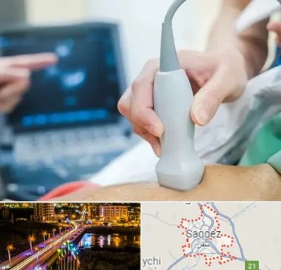 اکو قلب شبانه روزی در سقز