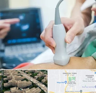 اکو قلب شبانه روزی در اکباتان 