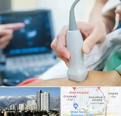 اکو قلب شبانه روزی در شهرک غرب 