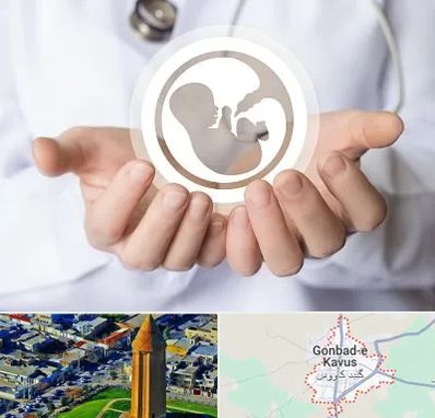 کلینیک ناباروری در گنبد کاووس