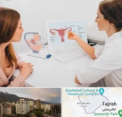 فوق تخصص نازایی در زعفرانیه