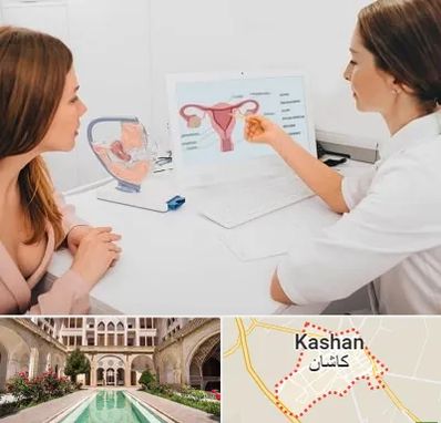 فوق تخصص نازایی در کاشان