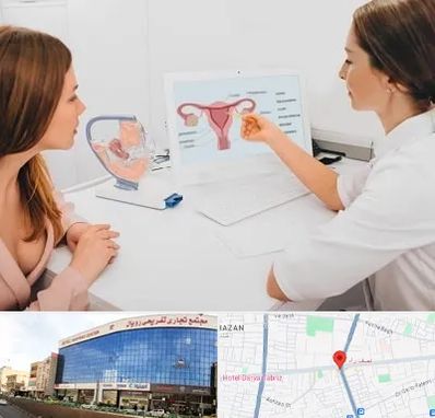 فوق تخصص نازایی در نصف راه تبریز