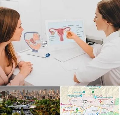 فوق تخصص نازایی در منطقه 1 تهران